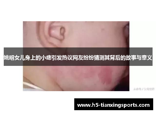 姚明女儿身上的小痣引发热议网友纷纷猜测其背后的故事与意义